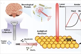 침으로 뇌신경 질환 조기 진단한다... AI 기반 센서 개발 - 뉴스 썸네일 이미지