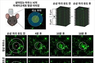 뇌 면역 균형 회복을 통한 알츠하이머병 치료 새로운 길 제시 - 뉴스 썸네일 이미지